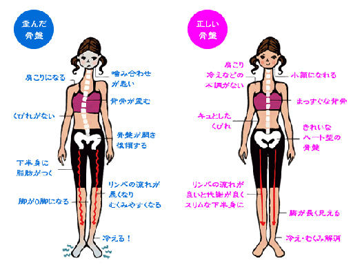 猫背・骨盤のゆがみで様々な不調が発生