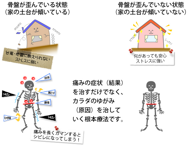 骨盤矯正や整体で猫背・姿勢矯正しないと起きる様々な不調