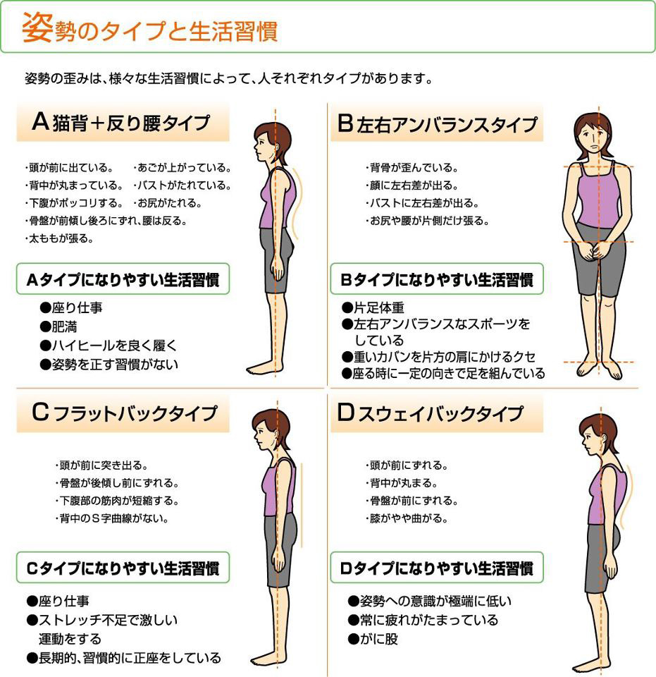 猫背や姿勢のゆがみで分かれる4タイプ