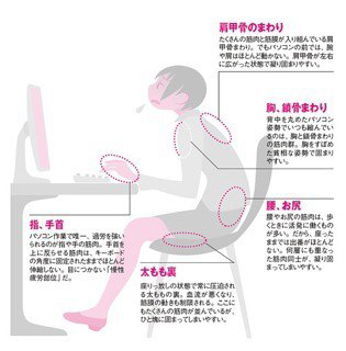 仕事でパソコンを使う際に骨盤に負荷がかかると頭痛・肩こりの原因に